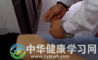 民间中医 腿部透针疗法