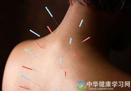 针灸止痛穴位
