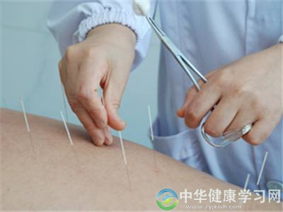 针灸怎样选穴位?