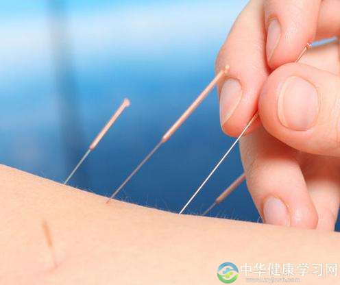 常用的针灸针具有哪些?