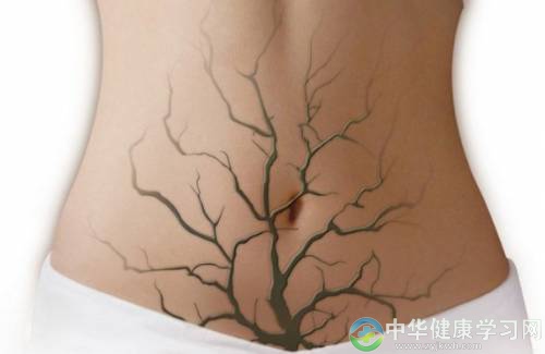 要养生,排毒不可不做!5个简单易行排毒法