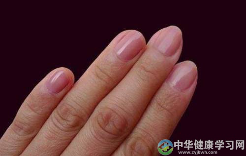 半月痕与健康的关系是真的吗?半月痕浅谈