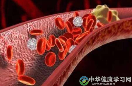 如果你近来经常出现这3个症状,注意了,可能是血栓前兆